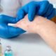 Post-Surgery Infections May Mainly Be Caused by Skin Bacteria