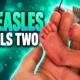 Pennsylvania measles two deaths unvaccinated infant